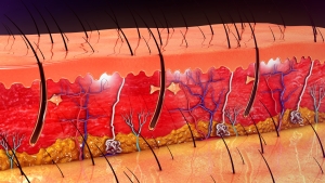 dreamstime_xl_73450343 jouvelline