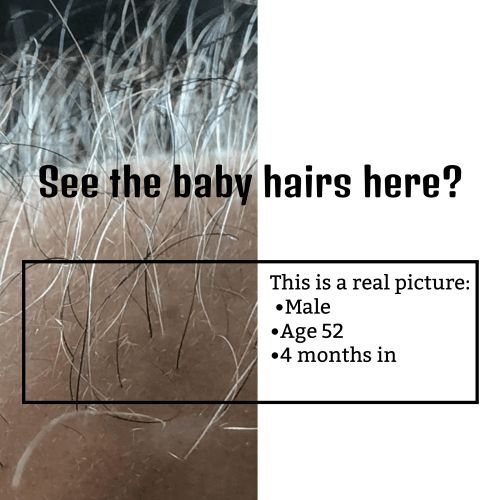 Hair Catalyst Good results on Google SERP when searching for 'Hair vitamins'