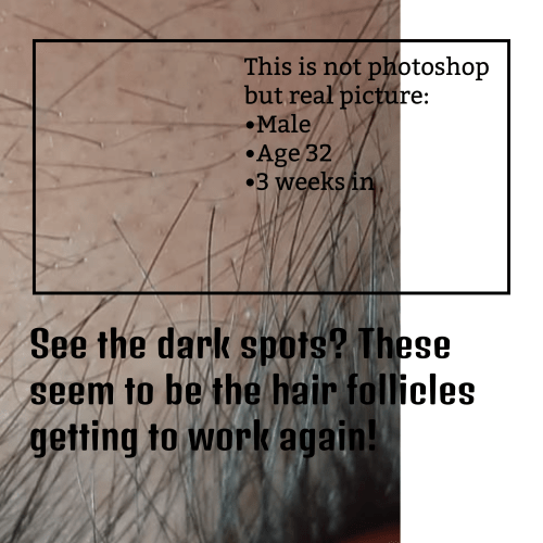 Hair Catalyst Good results on Google SERP when searching for 'Hair vitamins'